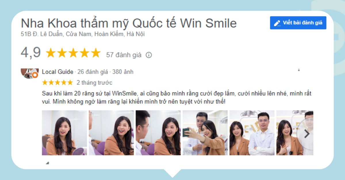 review-boc-rang-su-nha-khoa-win-smile