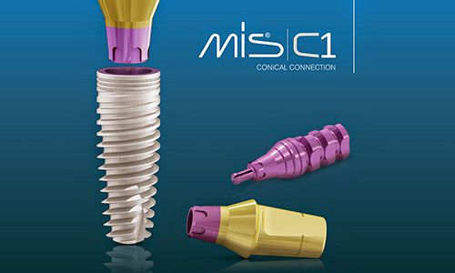 implant-mis-c1-duc