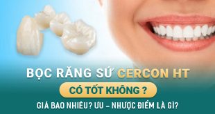 boc-rang-su-cercon-HT-co-tot-khong