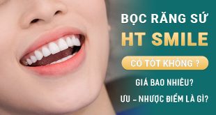 boc-rang-su-ht-smile-co-tot-khong