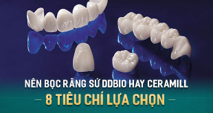 boc-rang-su-ddbio-hay-ceramill