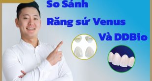 so-sanh-boc-rang-su-venus-va-ddbio