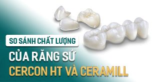 so-sanh-chat-luong-rang-su-cercon-HT-va-Ceramill