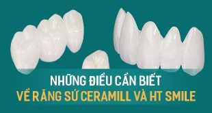 so-sanh-rang-su-ceramill-va-ht-smile