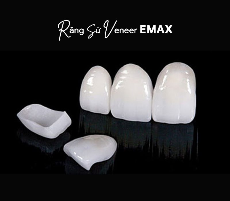 Răng sứ Veneer Emax