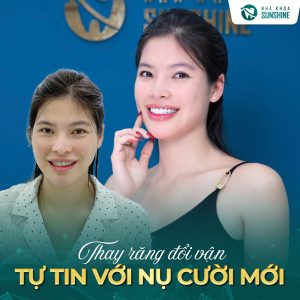 nha-khoa-boc-rang-su-uy-tin